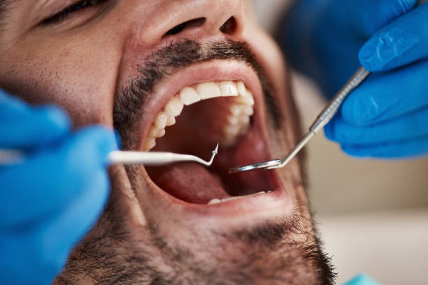 Best Broken Tooth Emergency  in Martin, TN